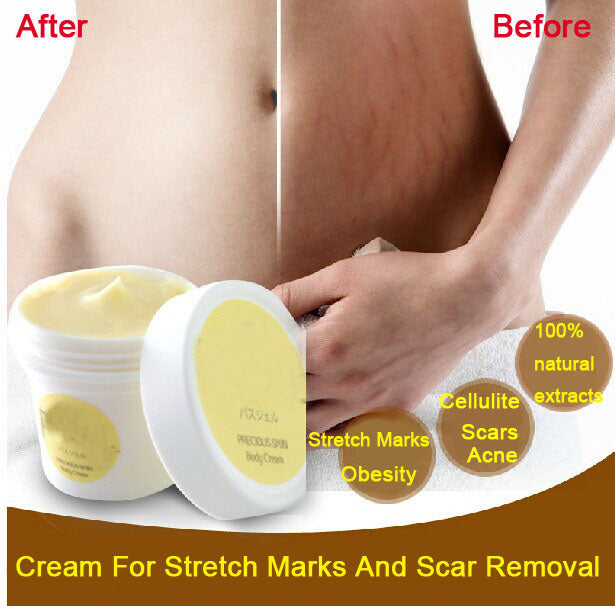 Thailand pasjel precious Skin Body Cream  stretch marks remover scar removal powerful postpartum obesity pregnancy cream